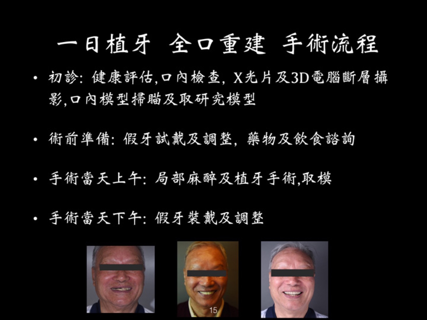 一日植牙全口重建案例圖例 3