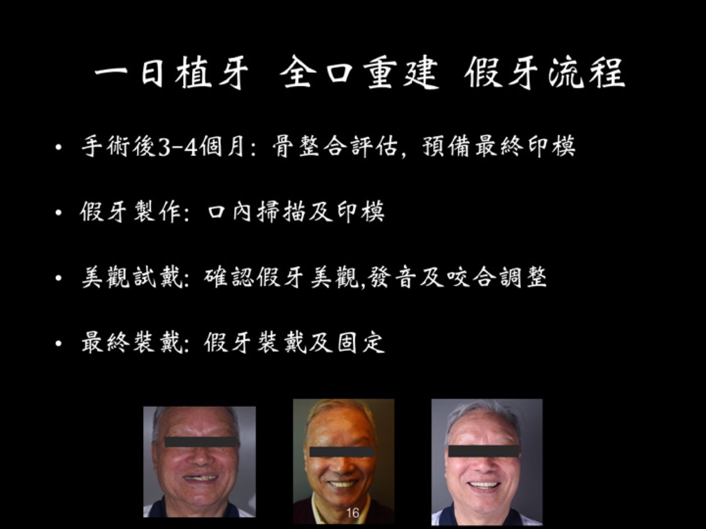 一日植牙全口重建案例圖例 4
